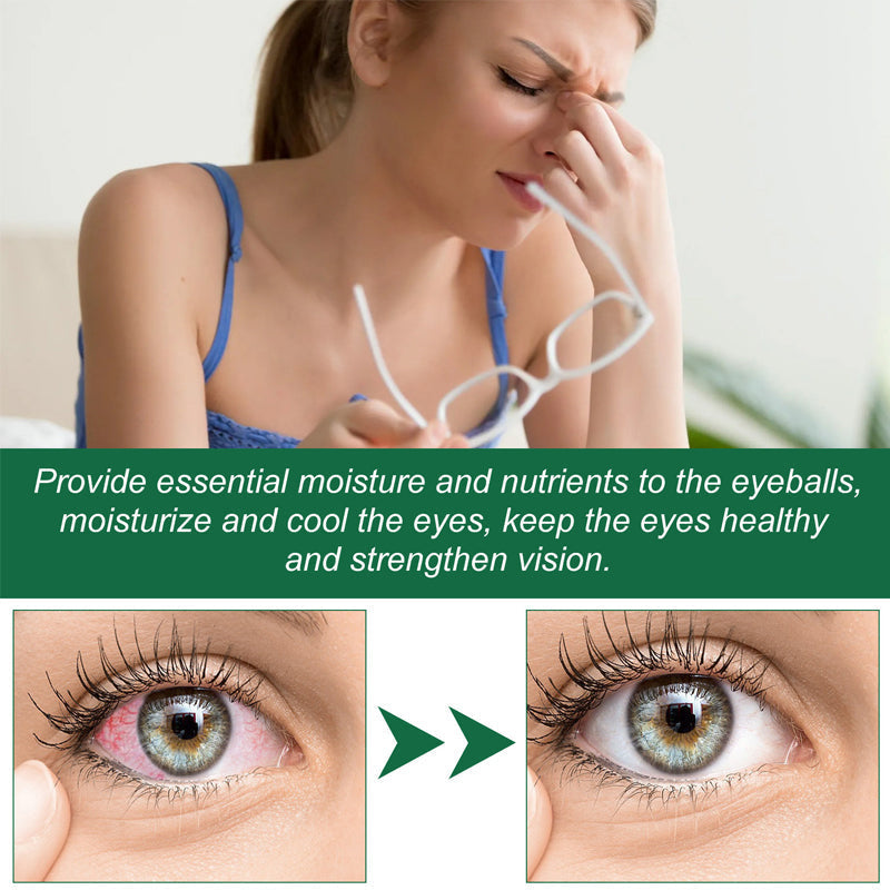 BBOJI™ Vision Recovery Elixir——Completely Cure Eye Conditions in Just 7 Days