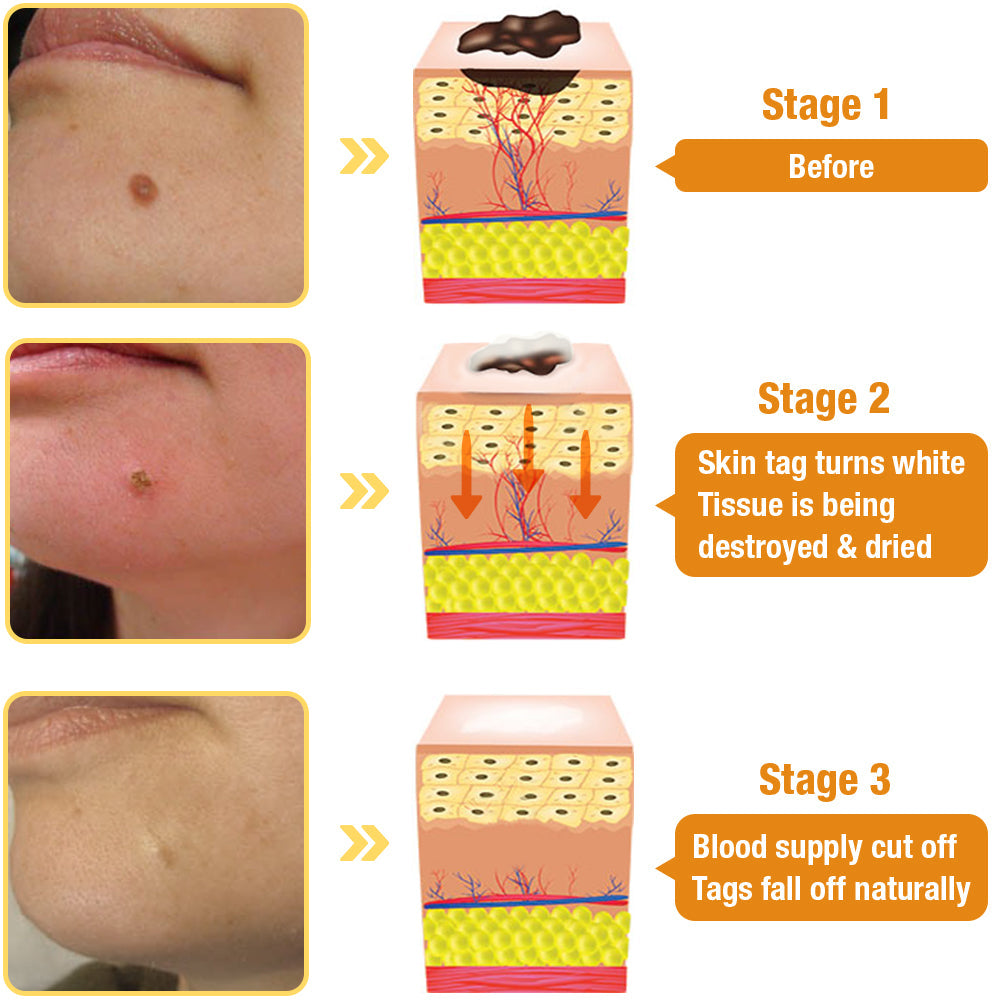 โจ ๐๐๐ฌ๐ญ ๐๐๐ฒ ๐๐ข๐ฌ๐๐จ๐ฎ๐ง๐ญ: 60% ๐๐
๐
๐AQAโข TagRecede Bees Treatment Spray